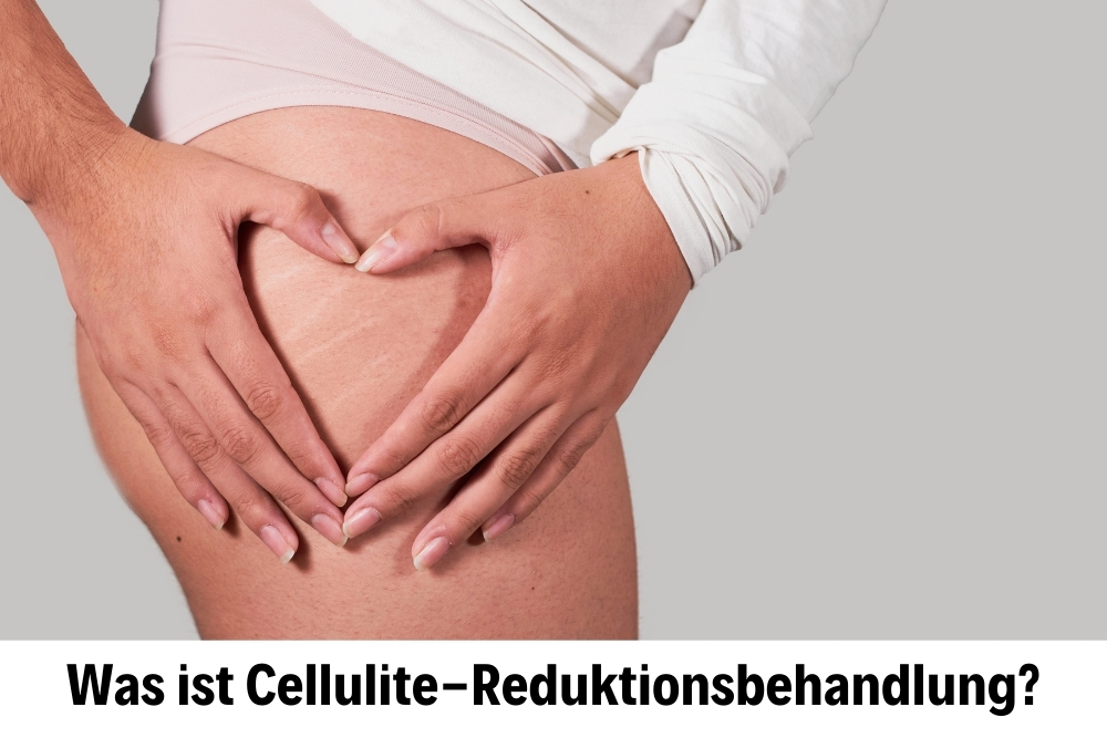 Selülit Selülit