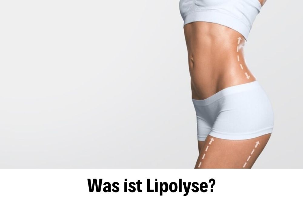 Lipolyse Lipolyse
