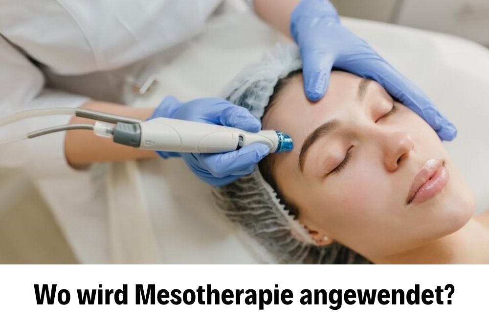 Mezoterapi Mezoterapi